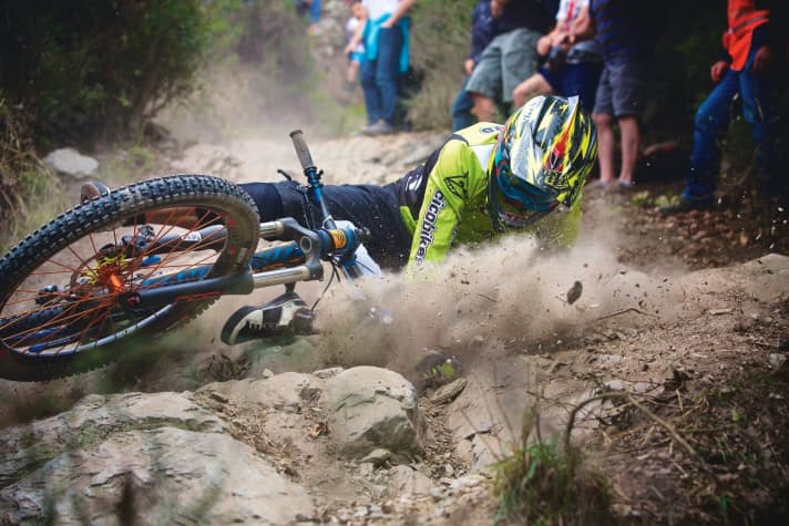 "It doesn't have to have been a direct fall onto the head for a head contusion to occur," says expert Lorenzl.