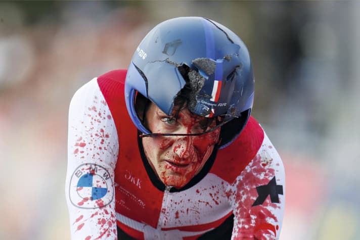 Sicherheit im Rennradsport: Nach schwerem Sturz setzt Stefan Küng bei der WM 2023 das Rennen fort – blutüberströmt und mit zerborstenem Helm.