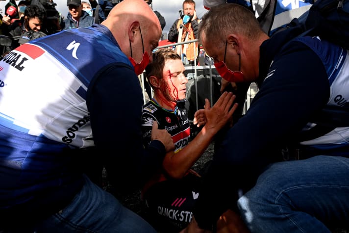 Remco Evenepoel a subi une coupure au-dessus de l'œil droit lors d'une chute à l'arrivée de la troisième étape.