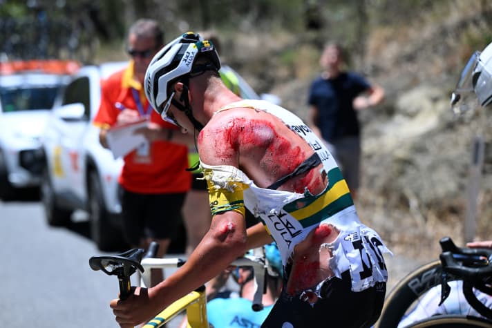 Ouch! Luke Plapp has left skin in a crash on stage 3 of the Tour Down Under.