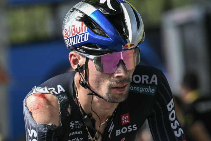 Man with scratches: Primož Roglič after a crash at last year's Tour - he later abandoned the race