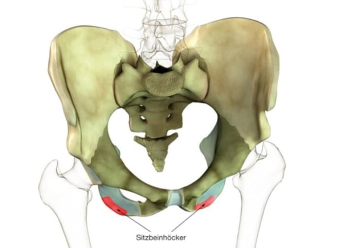   With ischial stress, the pressure is on the ischial tuberosities. This can also lead to pressure pain. However, with frequent training, the ischial tuberosities become accustomed to the load; they are anatomically designed for this.
