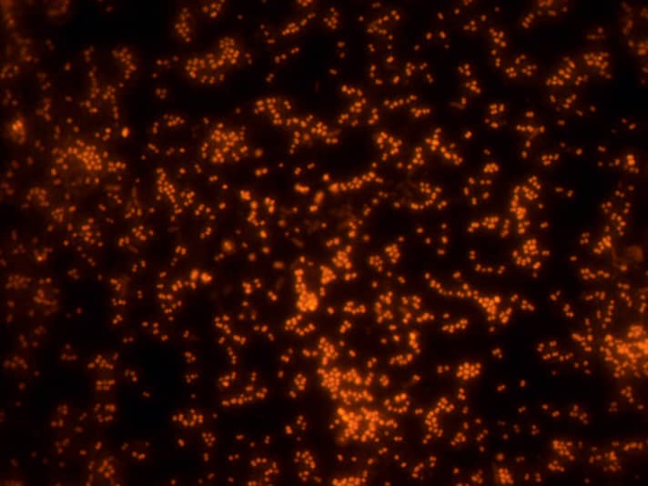 The bacteria glow under the microscope like small cities on a night-time photograph of the earth taken from space. This is made possible by a unique method of introducing colour molecules into the cells.