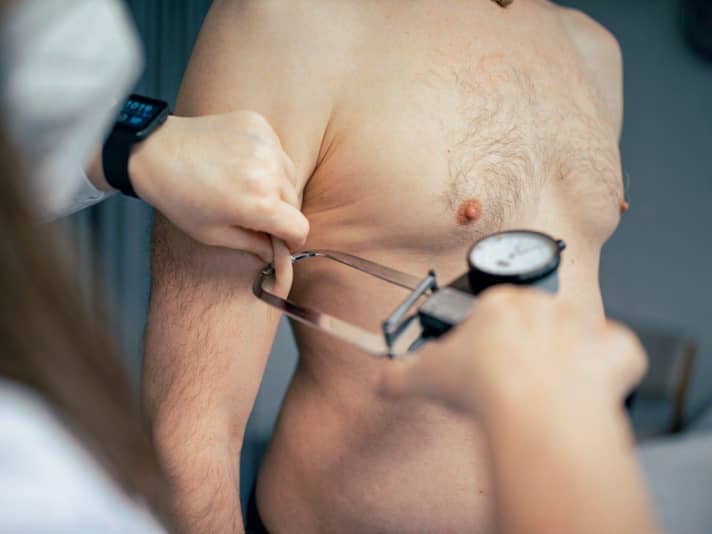 The skin fold measurement using caliper forceps reveals the fat layer directly under the skin.