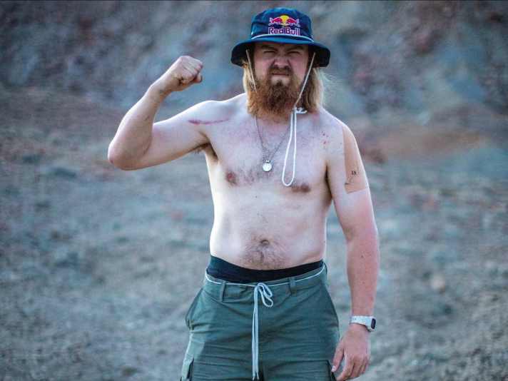 Scarred by falls and hard work: freeride star Brage Vestavik.