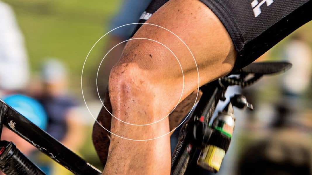RATGEBER Knieschmerzen beim Radfahren verhindern BIKE