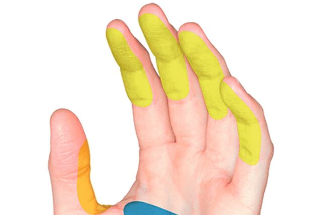 The hand has two major functional problem areas on the grip: palms are slightly concave in their "construction", i.e. hollow (blue), and high pressure on the metacarpal virtually presses them flat.