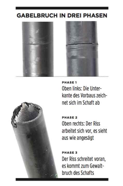Gabelbruch in drei Phasen