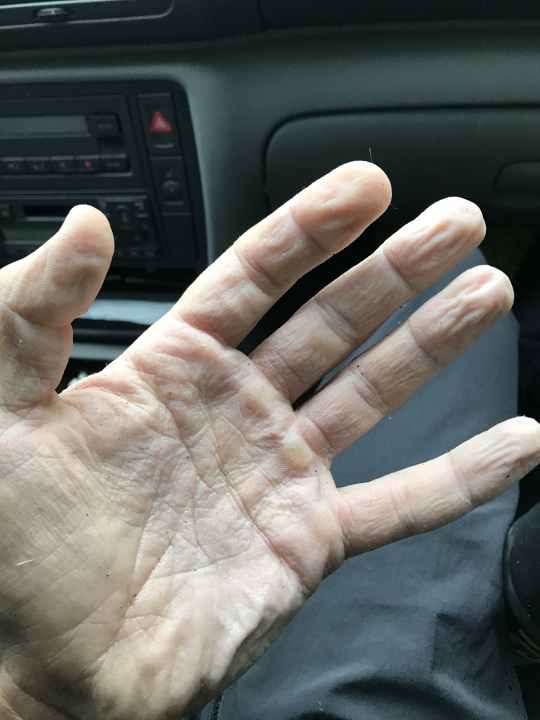 Keine Sorge, das Leben kehrte in die Hände unseres Bloggers wieder zurück