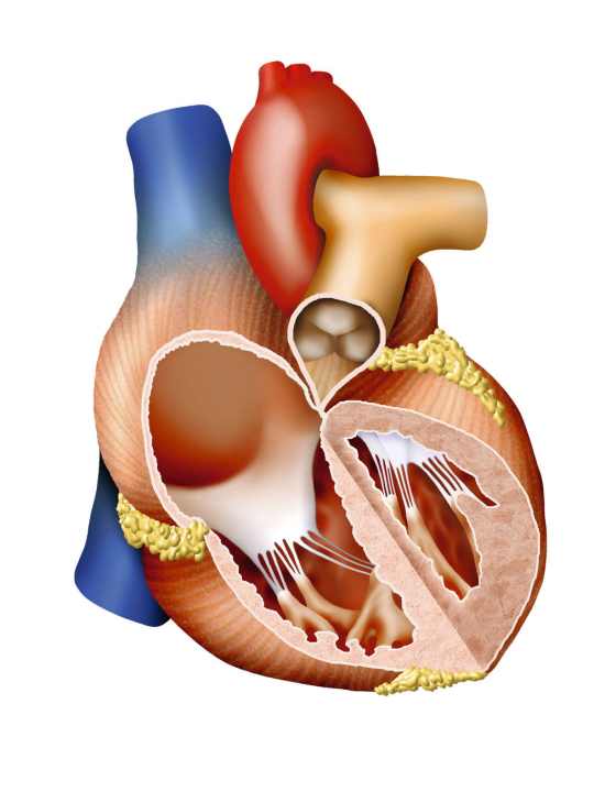   Verlieren die Herzklappen durch Alterung oder Entzündung ihre Beweglichkeit, wird der Blutfluss erschwert. Eine neue Klappe behebt die Aortenstenose, das Blut fließt wieder gleichmäßig.