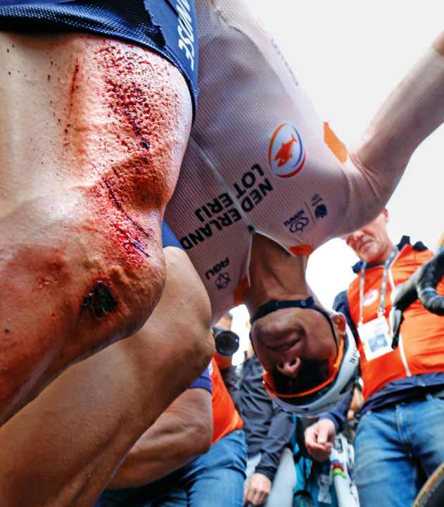 Erfolgsspur: Auf dem rechten Oberschenkel zeigt sich noch das Profil jenes Asphalts, auf den Mathieu van der Poel kurz vor seinem WM-Triumph stürzte.