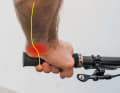 Bei Taubheitsgefühlen in Ring und kleinem Finger lastet in der Regel zu viel Druck auf der Handaußenseite, wodurch der Ulnarnerv geklemmt wird. Ein ergonomischer Griff kann die Auflagefläche vergrößern und den Druck von den Nerven nehmen.