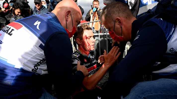 Blutüberströmter Evenepoel: Der Belgier kollidiert nach seinem Sieg auf der 3. Etappe der Vuelta a Espana im Ziel mit einer Frau und erleidet eine Platzwunde über dem rechten Auge. Vuelta a Espana, 3. Etappe, 28. August 2023