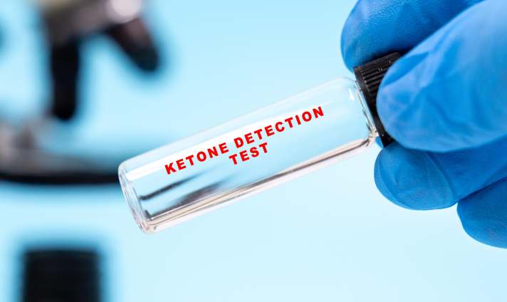 Einen solchen Test wird es im Radsport erst einmal nicht geben. Die UCI spricht kein Verbot gegen Ketone aus