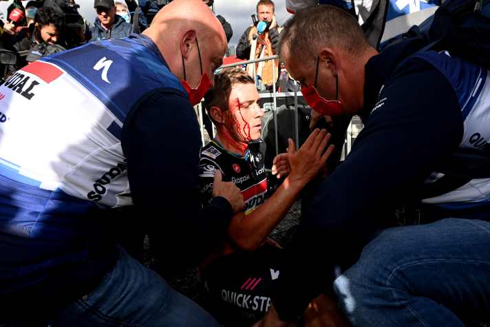 Remco Evenepoel erlitt bei einem Sturz im Ziel der 3. Etappe einen Cut über dem rechten Auge