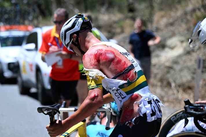 Aua! Luke Plapp hat Haut gelassen bei einem Sturz auf der 3. Etappe der Tour Down Under.