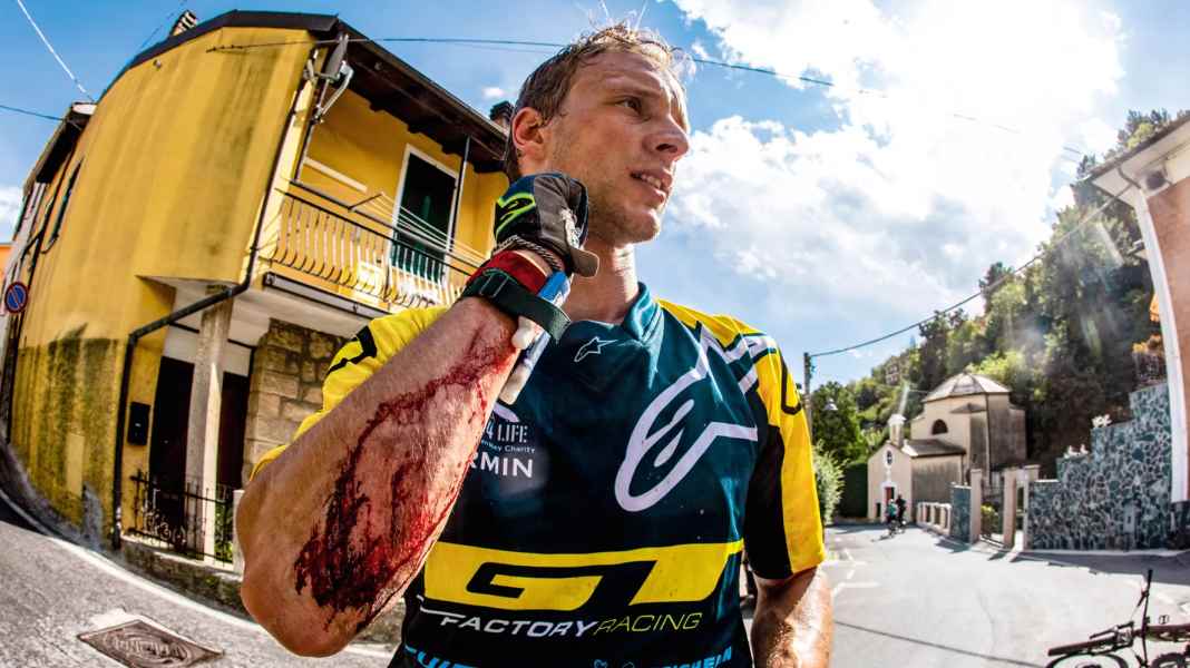 Pro & Contra: Brauche ich Ellbogenschoner beim Biken?