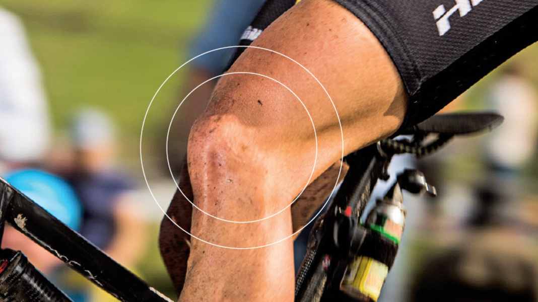 RATGEBER: Knieschmerzen beim Radfahren verhindern