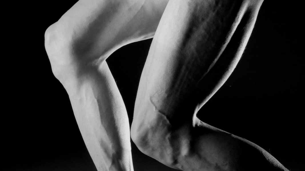Kniebeschwerden: Patellaspitzensyndrom - Rennrad-Pause wegen Patellaspitzensyndrom?