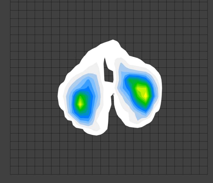 Die Druckmessbilder geben Aufschluss über die Belastung von Sitzknochen und Dammbereich. Außerdem sieht man durch die Farben, wo die stärkste Belastung auftritt.