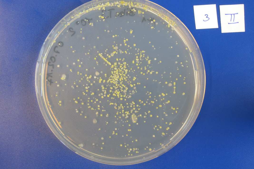 Auf sogenannten Agar-Platten ist ein Nährmedium aufgebracht. Davon ernähren sich die Bakterien und wachsen dann in Kolonien heran (gelbe Punkte).