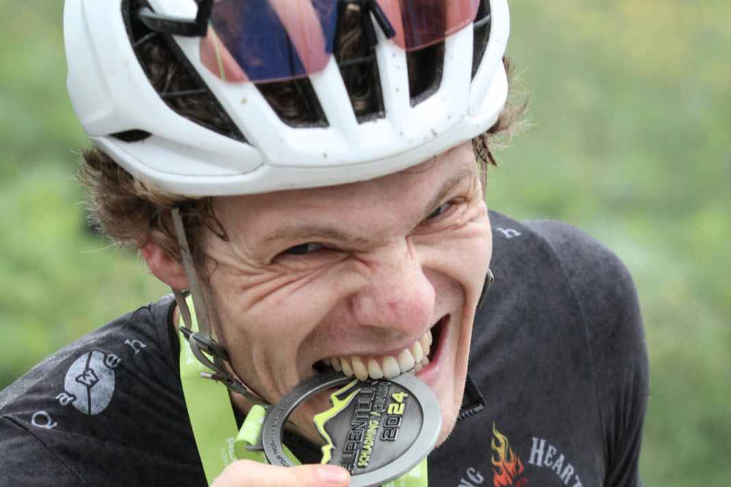 Vereinfacht ausgedrückt: Gesunde Zähne gewinnen Medaillien. Jedenfalls können Zahnprobleme Biker ordentlich ausbremsen.