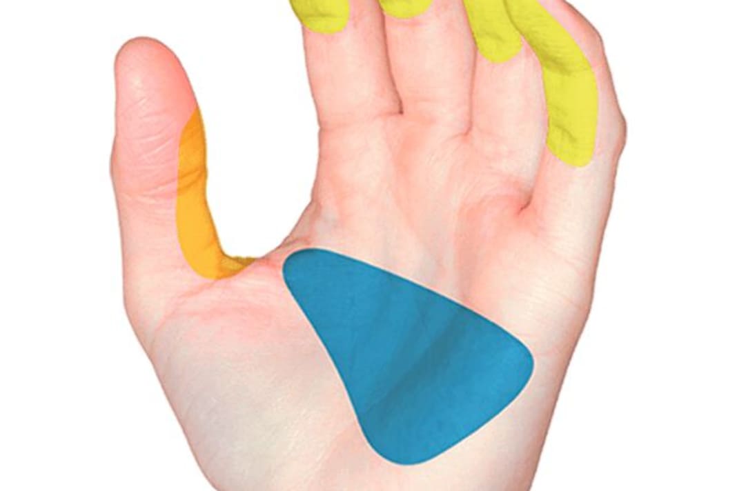 Zwei große funktionale Problemzonen hat die Hand am Griff: Handflächen sind in ihrer „Konstruktion“ leicht konkav, also hohl (blau), hoher Druck an der Mittelhand presst sie quasi platt.