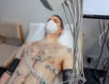 Ruhe-EKG und gleichzeitige Blutdruck-Messung an Armen und Knöcheln zur Ermittlung des ABI-Werts.