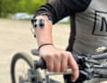 Mit dieser Technik am Arm sollen die Testpersonen ihre Runden im Bikepark drehen.