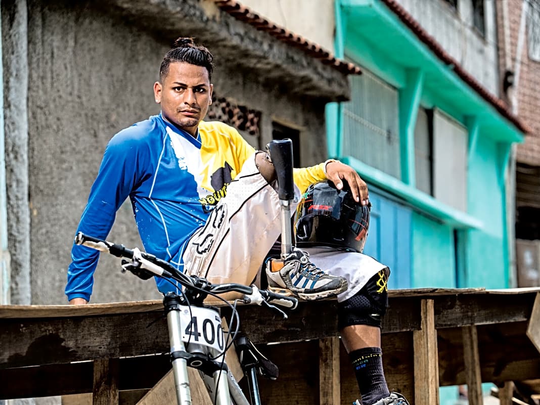 Harte Burschen: Alexon Dias wagt sich trotz Beinprothese in die Downhills.