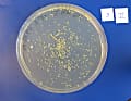 Auf sogenannten Agar-Platten ist ein Nährmedium aufgebracht. Davon ernähren sich die Bakterien und wachsen dann in Kolonien heran (gelbe Punkte).