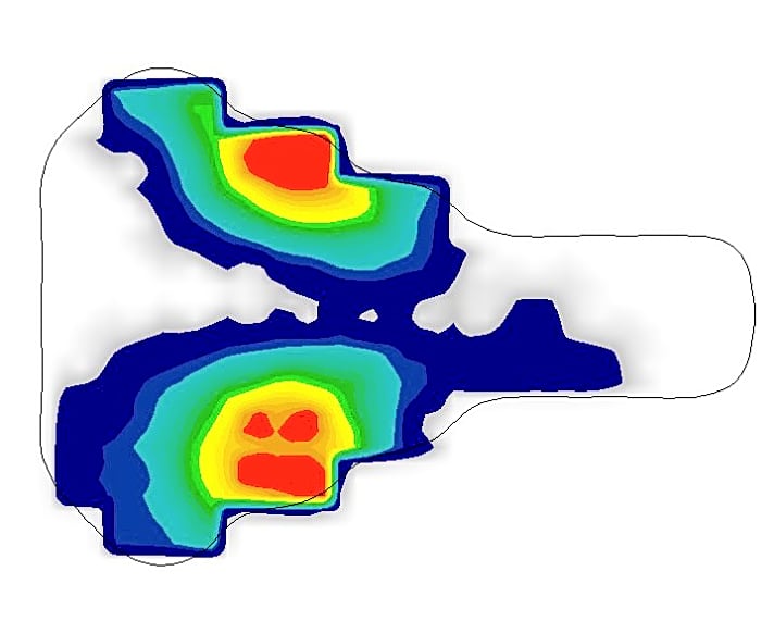   Blaue Flächen bedeuten wenig Druck, rote Flächen hohe Druckbelastung. Auch eine ungleichmäißge Verteilung kann entlarvt werden.