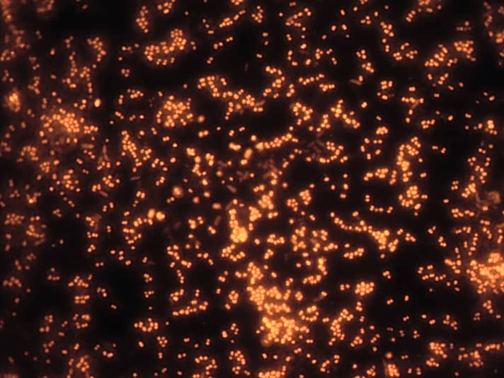   Wie kleine Städte auf einer Nachtaufnahme der Erde aus dem Weltall leuchten die Bakterien unter dem Mikroskop. Möglich macht das eine einzigartige Methode, Farbmoleküle in die Zellen einzuschleusen.
