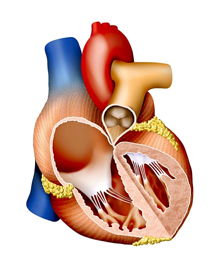   Verlieren die Herzklappen durch Alterung oder Entzündung ihre Beweglichkeit, wird der Blutfluss erschwert. Eine neue Klappe behebt die Aortenstenose, das Blut fließt wieder gleichmäßig.