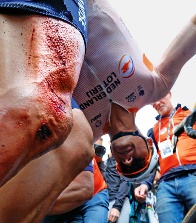 Erfolgsspur: Auf dem rechten Oberschenkel zeigt sich noch das Profil jenes Asphalts, auf den Mathieu van der Poel kurz vor seinem WM-Triumph stürzte.